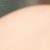 Usuwanie blizn – peeling chemiczny